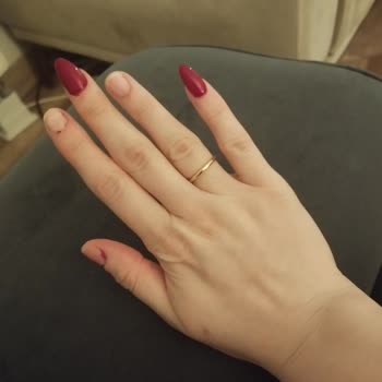 Ağrılı Tırnak İşlemi Ve Kötü Hizmet Deneyimi