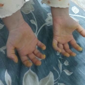 Kötü Kokan Gokidy Oyun Hamuru Hayal Kırıklığı Yarattı!