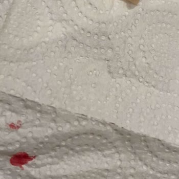 Hijyen Eksikliği Ve Sağlık Tehdidi: Manikür Kabusu