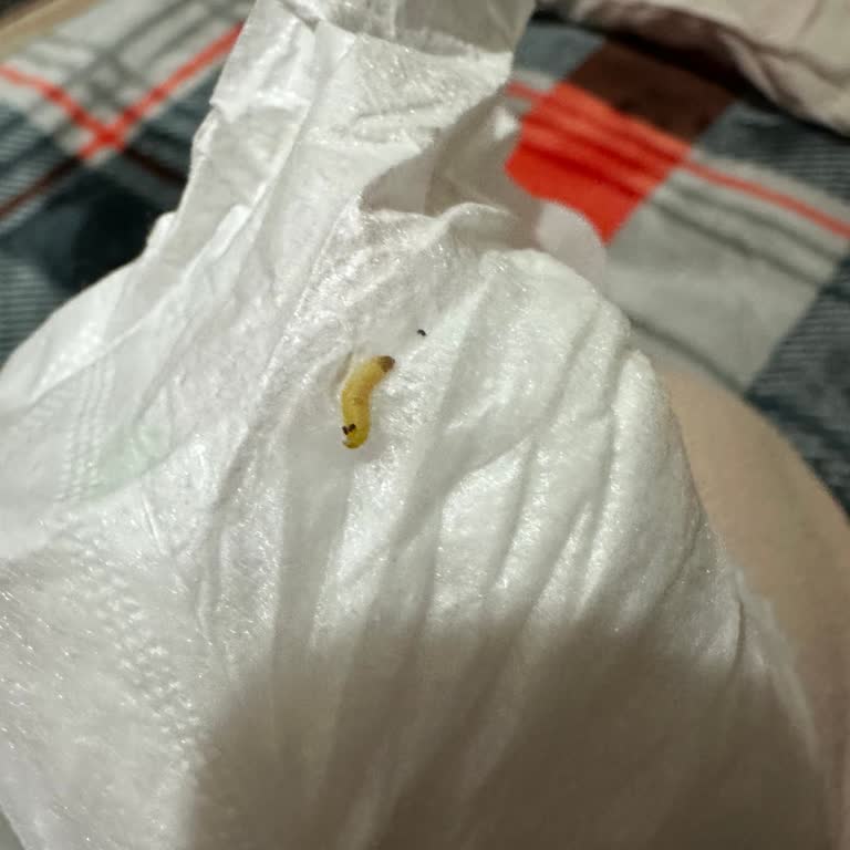 Bebek Bezinde Kurt Sorunu Çocuklarımızın Güvenliği Tehlikede