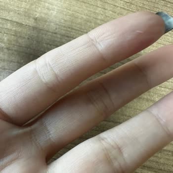 Cam Parçası Tehlikesi: Ürün Açarken Yaşanan Kesik