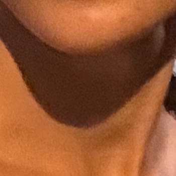 Dudak Dolgusu Hayal Kırıklığı