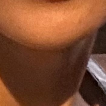 Dudak Dolgusu Hayal Kırıklığı