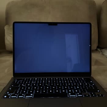 Hepsiburada'da Kaybolan Ürün Ve İlgisiz Müşteri Hizmetleri