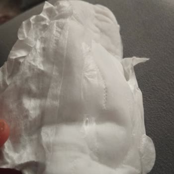 Molped'in Yapışkan Problemi: Güven Sarsıcı Deneyim