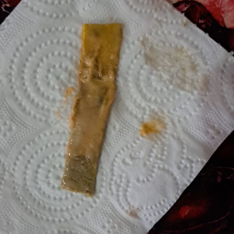 Hastanede Ameliyat Sonrası İhmal Ve Mağduriyet