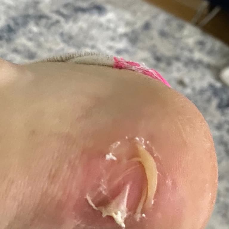 Puma Ayakkabılarım Ayağımı Vurdu!