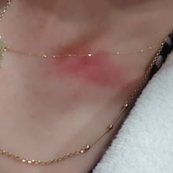 Soğuk Spa Deneyimi Ve Kaba Hizmet