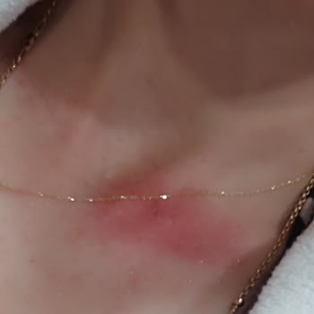 Soğuk Spa Deneyimi Ve Kaba Hizmet