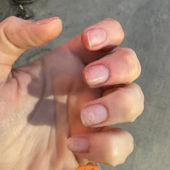 Özüm Cevher Beauty Şikayetçiyim