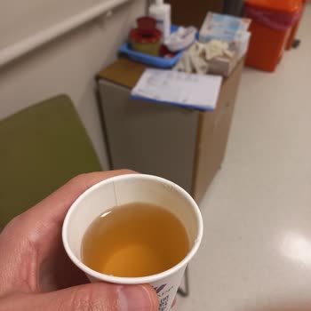 Otomat Mağduriyeti: Para Üstü Ve Ürün Sorunları