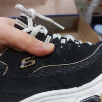 Skechers Ayakkabıda Yırtılma Ve SuperStep'in Garanti Süreci Sorunu