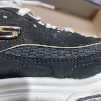 Skechers Ayakkabıda Yırtılma Ve SuperStep'in Garanti Süreci Sorunu
