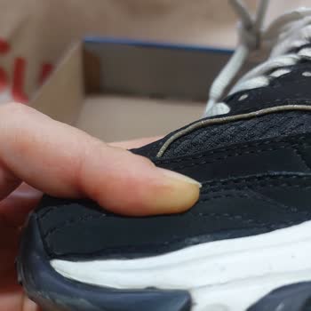 Skechers Ayakkabıda Yırtılma Ve SuperStep'in Garanti Süreci Sorunu