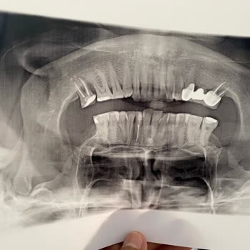 Diş Tedavisinde Yaşanan Sorunlar Ve İlgisizlik