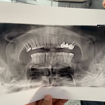Diş Tedavisinde Yaşanan Sorunlar Ve İlgisizlik
