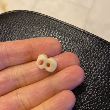 Diş Tedavisinde Yaşanan Sorunlar Ve İlgisizlik