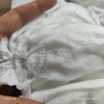 Bebek Bezinde Güven Sarsan Yabancı Madde
