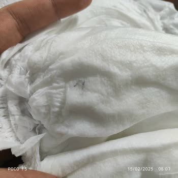 Bebek Bezinde Güven Sarsan Yabancı Madde