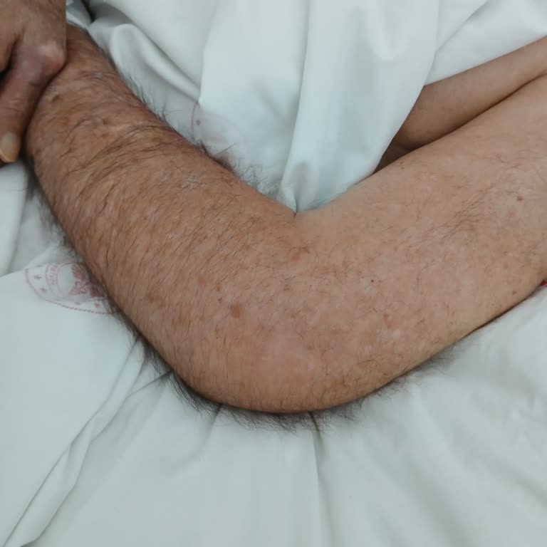 Hemşire İlgisizliği Ve Hasta Güvenliği Sorunu