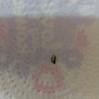 Peynirdeki Metal Cisim Dişimi Kırıyordu