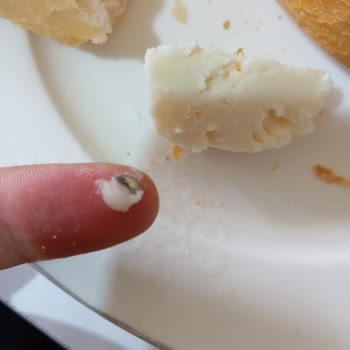 Peynirdeki Metal Cisim Dişimi Kırıyordu