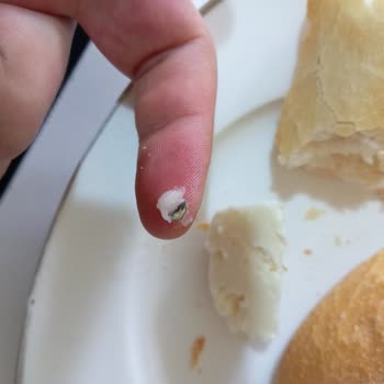 Peynirdeki Metal Cisim Dişimi Kırıyordu