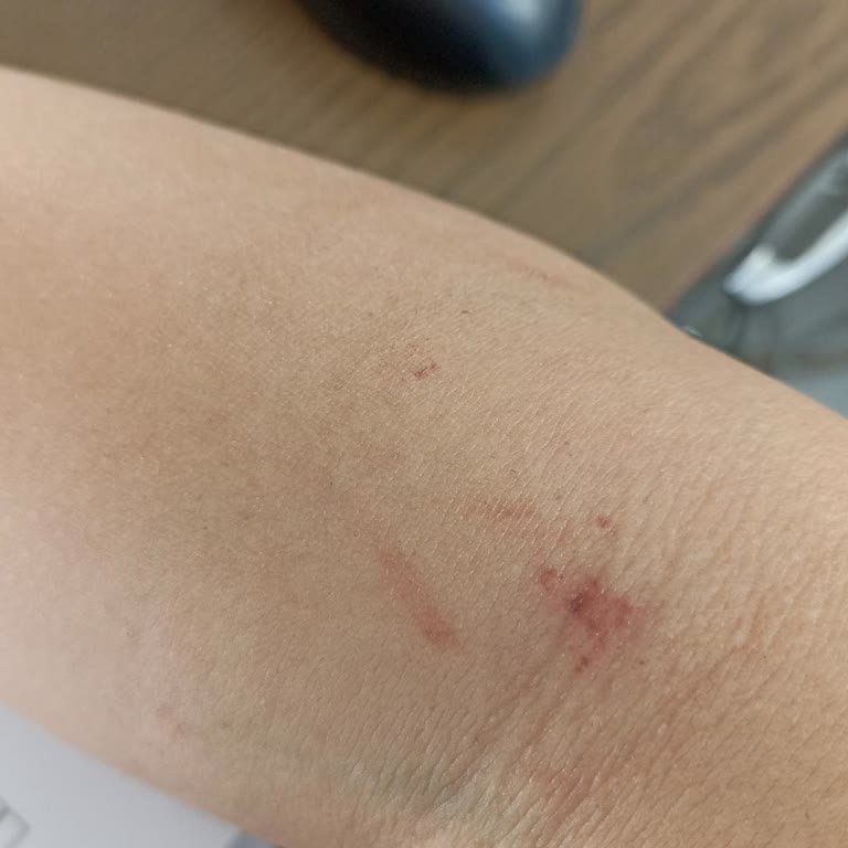 Rönesans Vip Güzellik Salonu Sorgun Şikayeti