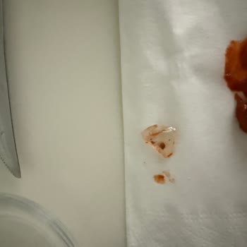 Tat Cevizli Ezme İçinde Tehlikeli Cam Parçası