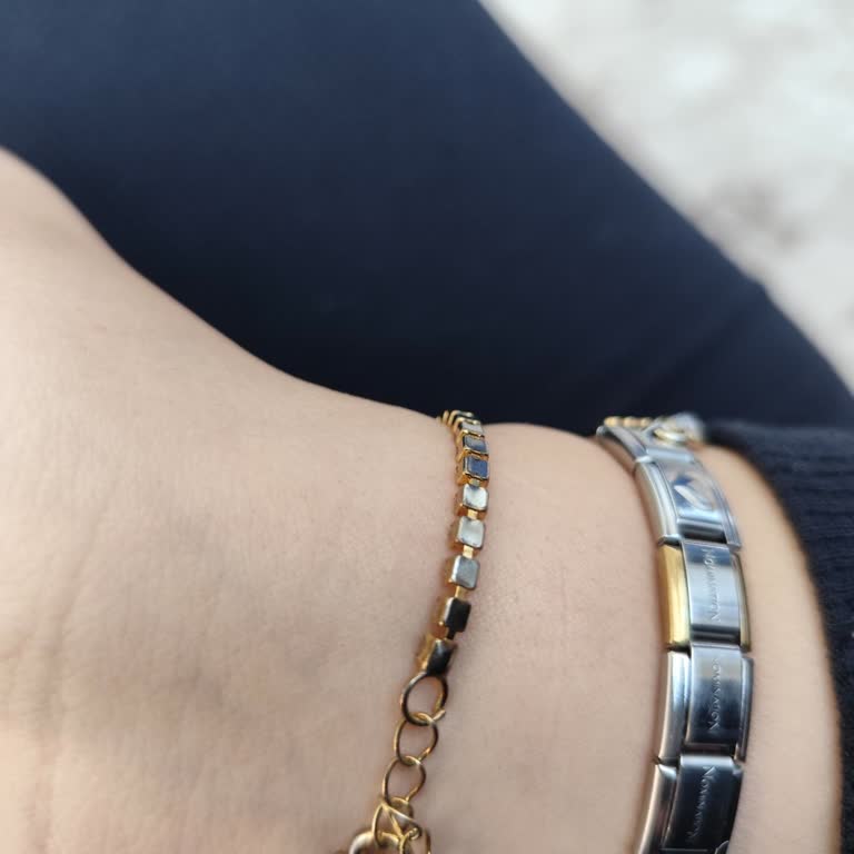 Sözde Çelik Bileklik 3 Günde Karardı Ve Soyuldu