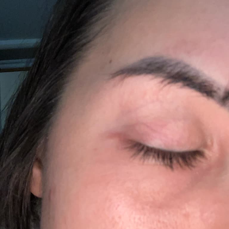 Microblading Sonrası Feci Kaş Deneyimi