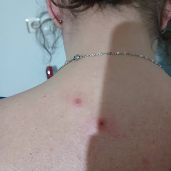 Hastane Ziyareti Sonrası Yaşanan Adaletsizlik