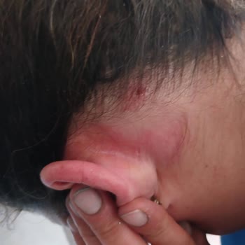 Hastane Ziyareti Sonrası Yaşanan Adaletsizlik