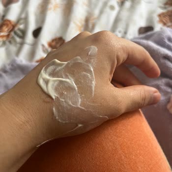 Orva İlaç Sanayi Expigment Kremde Cam Parçaları Şoku!