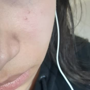 Cerave Krem Kızımın Cildini Mahvetti, Ücret İadesi İstiyorum