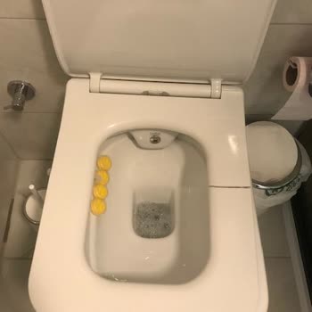 Turkuaz İbiza Klozet Kapağı 6 Ayda Kırıldı, Üretim Hatası Mı?