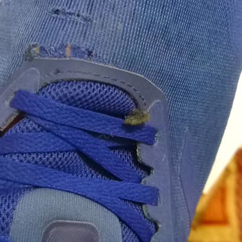 Adidas Ayakkabıda Hızlı Deformasyon Ve Müşteri Hizmetleri Hayal Kırıklığı