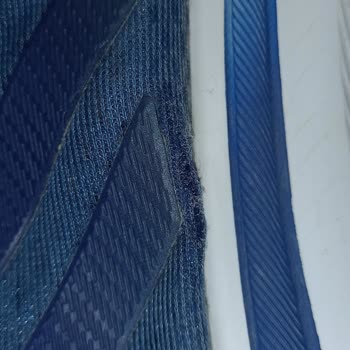 Adidas Ayakkabıda Hızlı Deformasyon Ve Müşteri Hizmetleri Hayal Kırıklığı