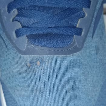 Adidas Ayakkabıda Hızlı Deformasyon Ve Müşteri Hizmetleri Hayal Kırıklığı