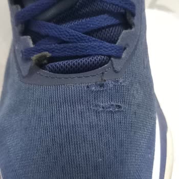 Adidas Ayakkabıda Hızlı Deformasyon Ve Müşteri Hizmetleri Hayal Kırıklığı