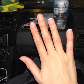 Manikür Sonrası Beklenmedik Sorunlar