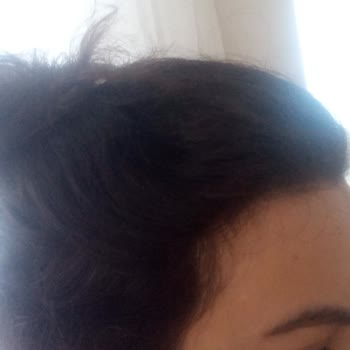 Saç Boyası Mağduriyeti: Beklenmedik Renk Sonucu