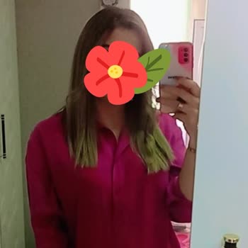 Saç Boyası Mağduriyeti: Beklenmedik Renk Sonucu