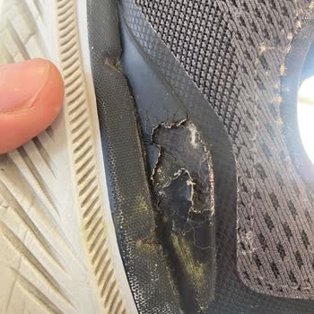 Skechers Ayakkabının Beklenmedik Kalite Sorunları Ve Yetersiz Garanti Hizmeti