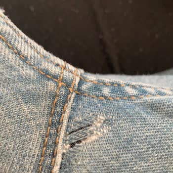 Colin's Kot Pantolonunda Tekrarlayan Deformasyon Sorunu
