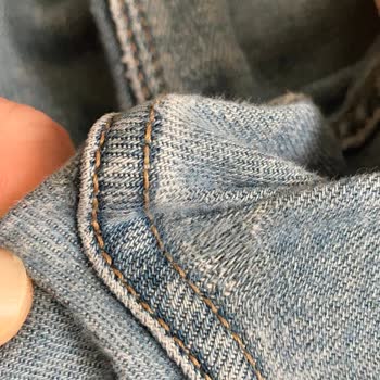 Colin's Kot Pantolonunda Tekrarlayan Deformasyon Sorunu