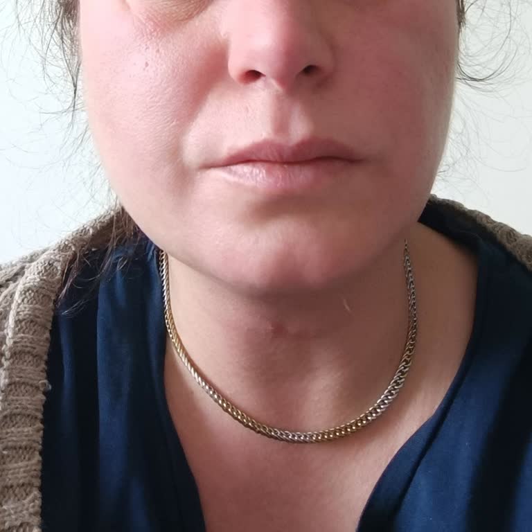 İbucold C Ciddi Yan Etkileri Var!