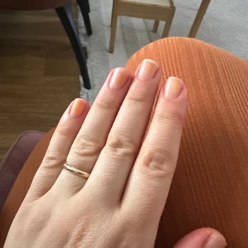 Pastel Oje Kullanımı Sonrası Tırnak Problemleri Ve Müşteri Memnuniyetsizliği