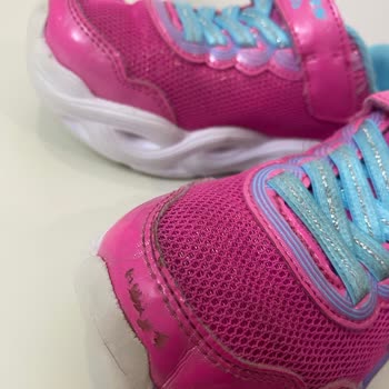 Skechers Mağazasının Garanti Sürecinde Yaşanan Hayal Kırıklığı