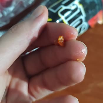 Patos Cipsin İçinden Çıkan Yabancı Madde Şoku